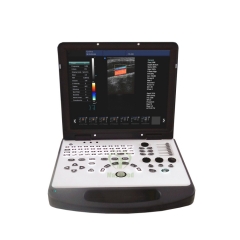 MY-A024A Laptop 4D Color Doppler Ultrasonic Diagnostic System Ultrasound Machine