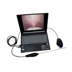 MY-P008M professional medical Portable electronic ENT endoscope