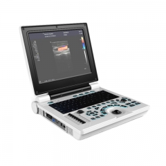 MY-A024N 12inch laptop color doppler ultrasound scanner machine