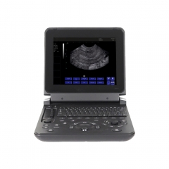 Professional medical MY-A007C Laptop BW Ultrasound Scanner