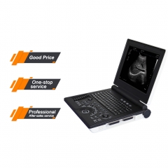 MY-A024A-N Portable color ultrasound forhuman rectal probe body check ultrasound