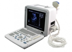 MY-A003C Portable Ultrasound Scanner